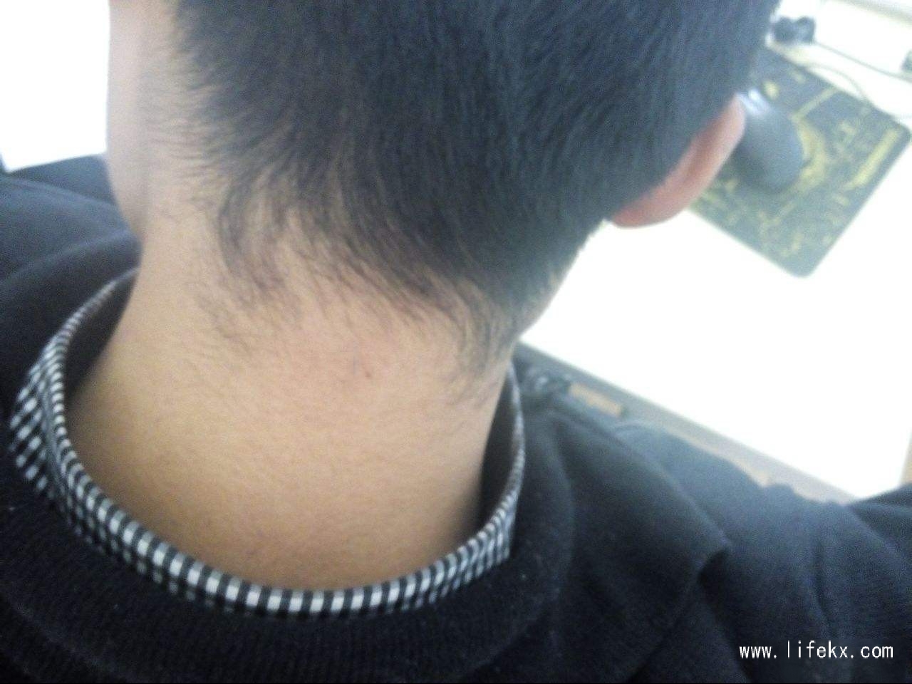 脖子上有痣的男人代表什么 脖颈上右侧有长痣代表什么 脖子上有痣的男人代表什么 脖颈上右侧有长痣代表什么