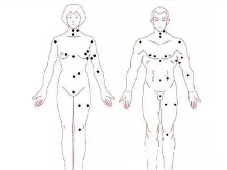 女人私处长有痣好不好图解 女性女生最私密部位有长痣 女人私处长有痣好不好图解 女性女生最私密部位有长痣